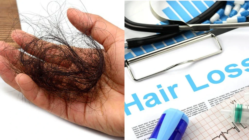 Health Benefits of Cinnamon for Hair Loss