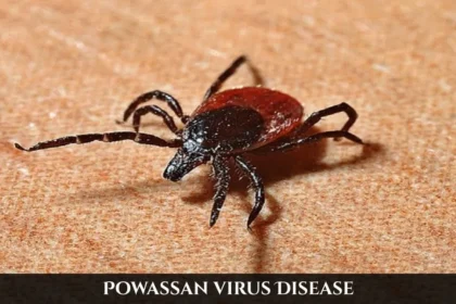 Powassan Virus Disease, Powassan Virus